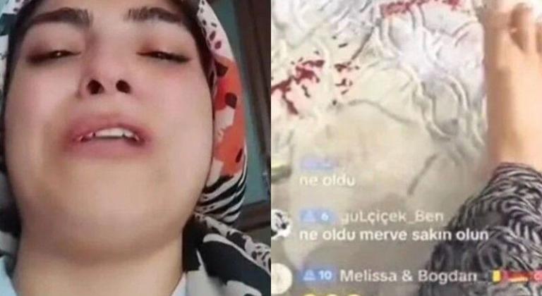 Çocuğu kanlar içindeyken TikTok yayını açtı