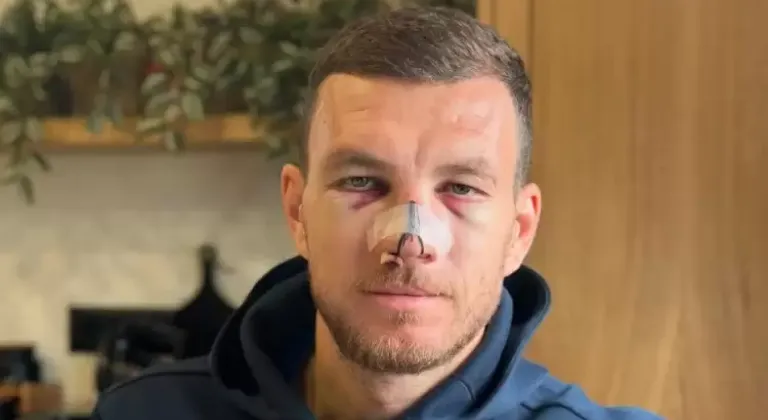 Edin Dzeko'dan paylaşım: Ya hep ya hiç