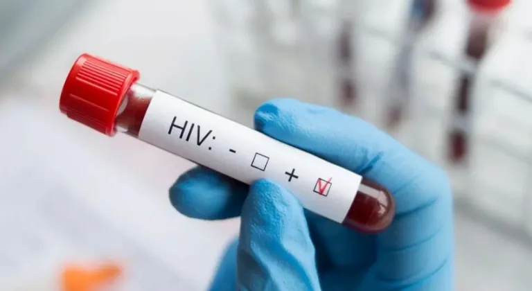 Eşinden HIV pozitif olduğunu sakladı! İşte istenen ceza!