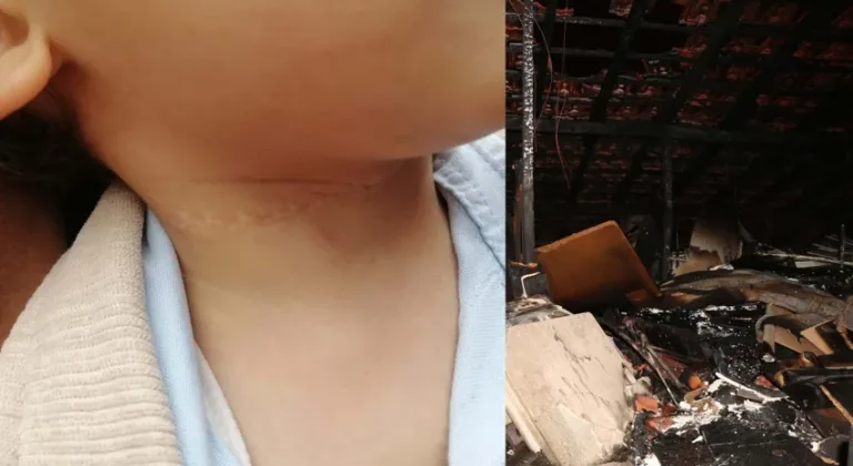 Eskişehir'de vahşet! Çocuğun boynunu kesti, evini ateşe verdi
