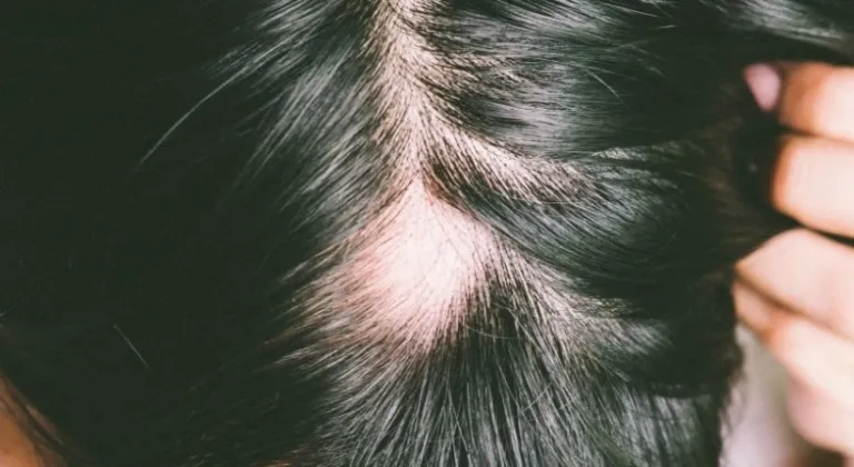 H vitamini nedir, nelerde var ve nasıl alınır?