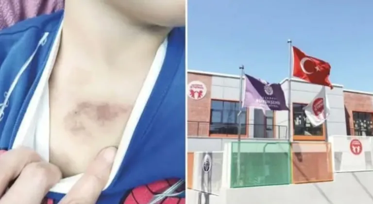 İBB kreşindeki istismar ve darp skandalında şoke eden ayrıntılar! Çıplak kameraya çekmiş