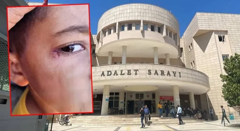 Okulda kan donduran olay: Öğrencinin yüzünde sigara söndürdü!