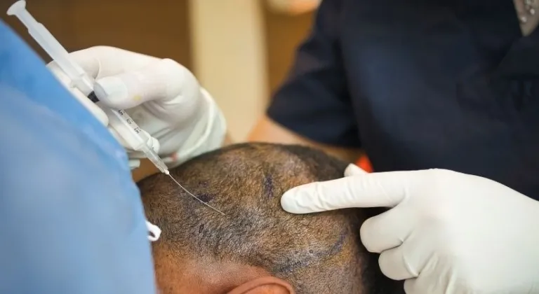 Saç ekimi sırasında fenalaştı, hayatını kaybetti