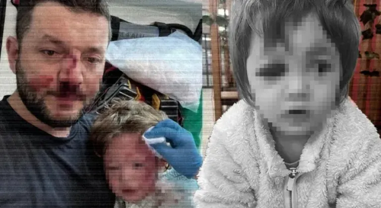 Yalova'daki komşu teröründe itiraf geldi! Minik İkra böyle yaralanmış...