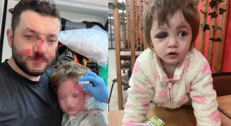 Yalova’da 14 aylık bebeğe saldırı: 36 yıla kadar hapis istendi