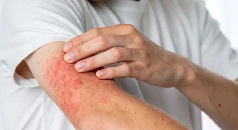 Zyrtec şurup nedir nedir, ne işe yarar, kimler kullanır ve fiyatı ne kadar?